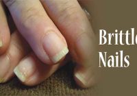 How do I treat my brittle nails? How do I treat my brittle nails?