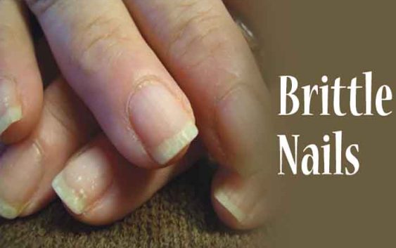 How do I treat my brittle nails?