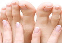 Everything you need to know about nail fungus