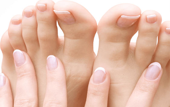 Everything you need to know about nail fungus