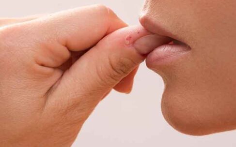 How to stop biting your nails?