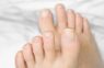 Natural remedies to treat thickening toenails